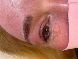 Best beauty treatments in Shrewsbury